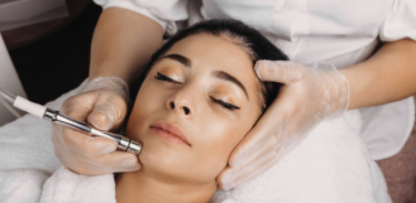 Laser Treatment 